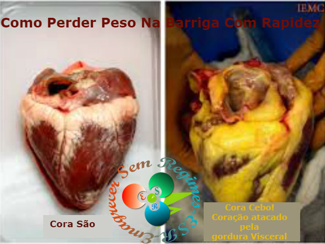 perder-peso-na-barriga3