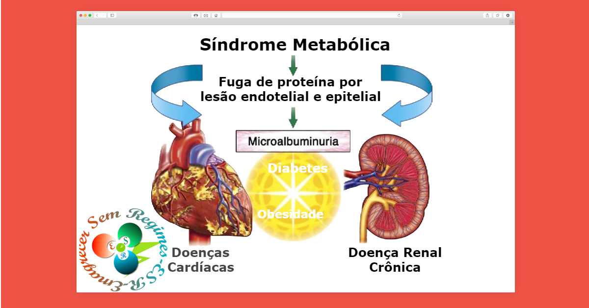 Síndrome metabólica